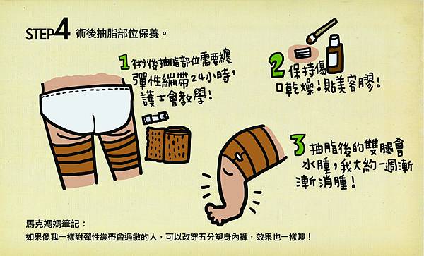 自體脂肪 淚溝 黑眼圈 眼袋 楊氏羅丹